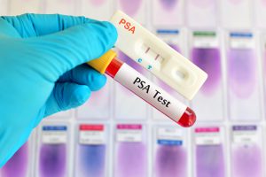 PSA test